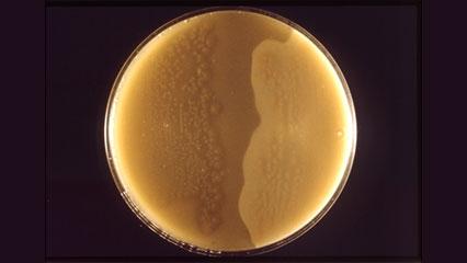 coltura batterica di C. perfringens in tuorlo d'uovo. 