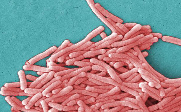 Il bacillo della legionella