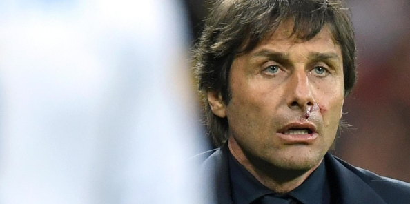 Antonio Conte - Ferito al naso ma non dall'Italia